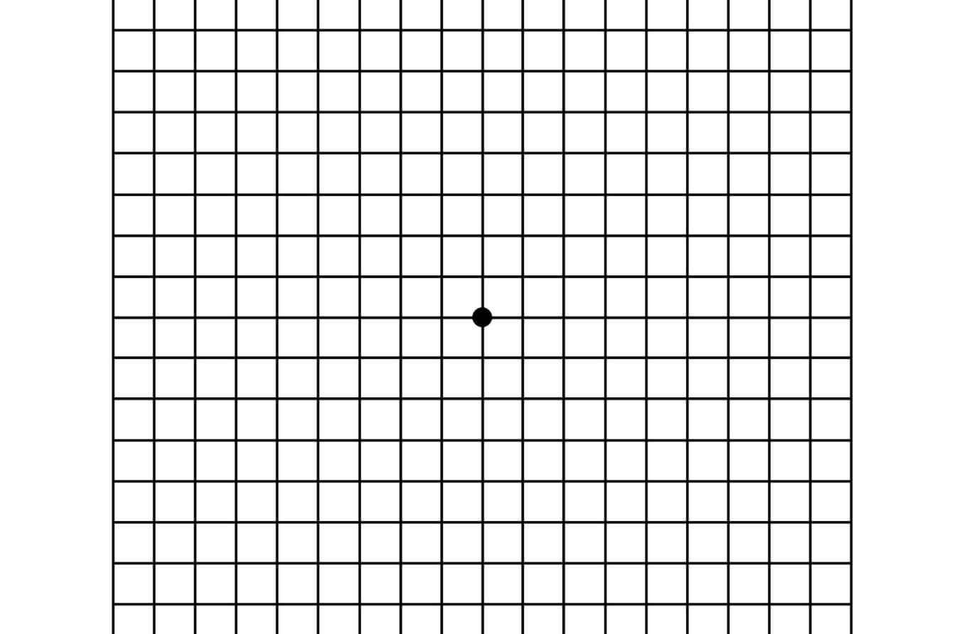 https://cdn.allaboutvision.com/images/amsler-grid.pdf