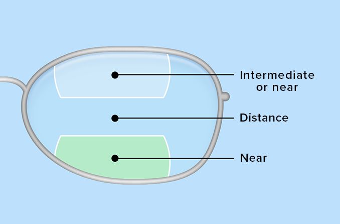 illustration of bifocal and trifocal lenses